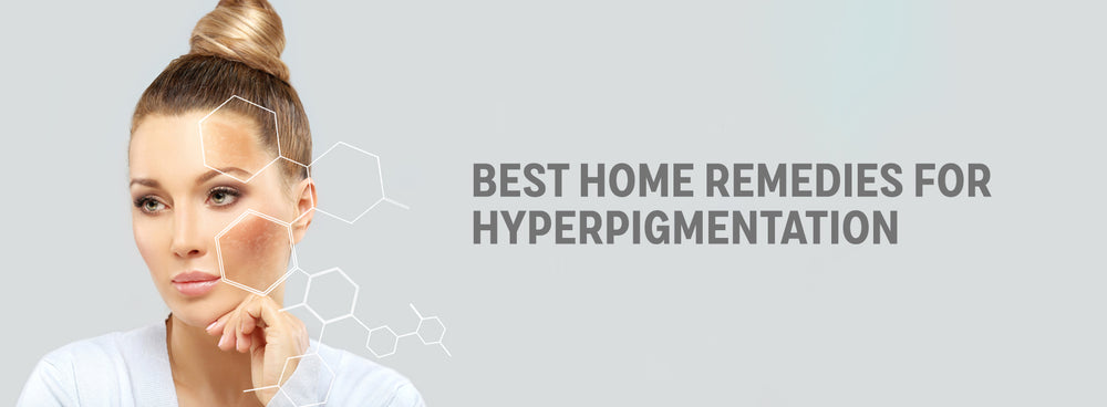 Best Home Remedies For Hyperpigmentation