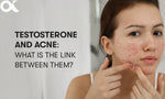 Testosterone & Acne: What is the Link between them? How does it cause Acne?