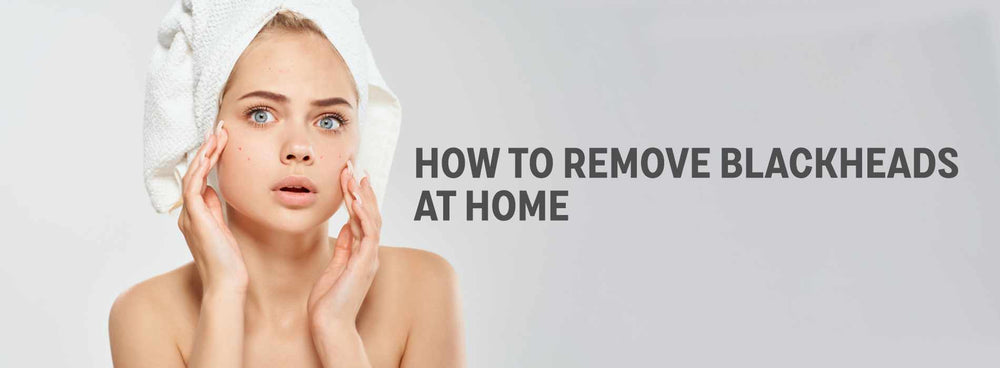 How to Remove Blackheads at Home